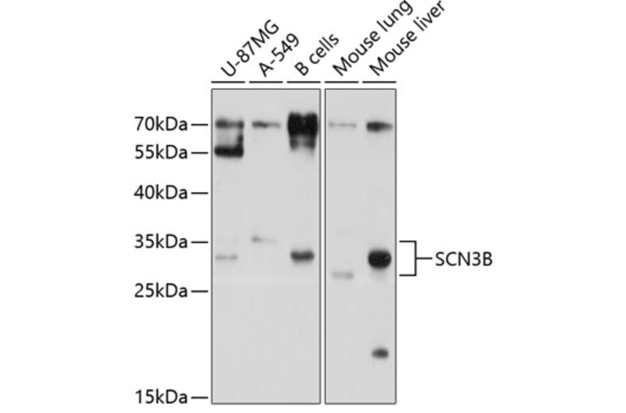 Western Blot - Anti-SCN3B Antibody (A11284) - Antibodies.com