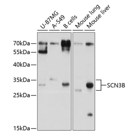 Western Blot - Anti-SCN3B Antibody (A11284) - Antibodies.com