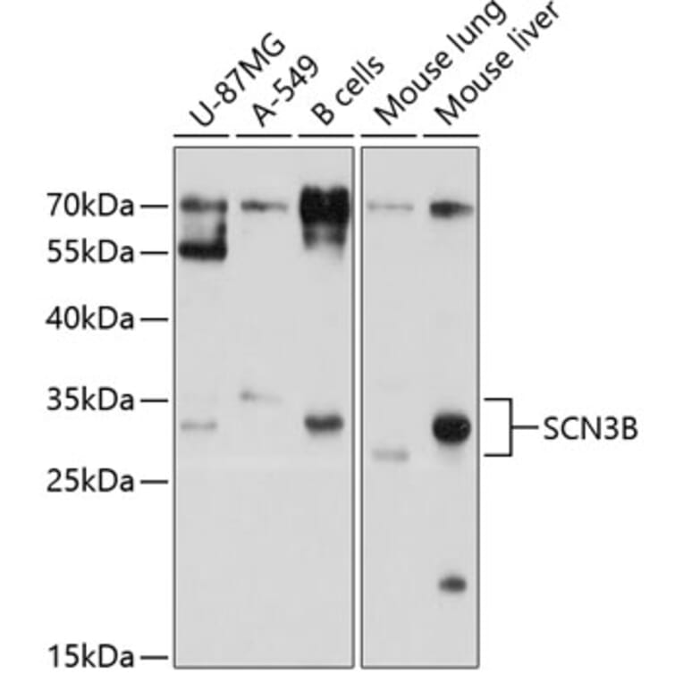 Western Blot - Anti-SCN3B Antibody (A11284) - Antibodies.com