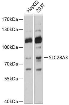 Western blot analysis of extracts of various cell lines, using Anti-SLC28A3 Antibody (A10320) at 1:1,000 dilution.
Secondary antibody: Goat Anti-Rabbit IgG (H+L) (HRP) (AS014) at 1:10,000 dilution.
Lysates / proteins: 25µg per lane.
Blocking buffer: 3% non-fat dry milk in TBST.
Detection: ECL Basic Kit (RM00020).
Exposure time: 1s.