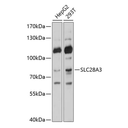 Western Blot - Anti-hCNT3 Antibody (A11285) - Antibodies.com