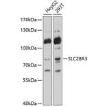 Western Blot - Anti-hCNT3 Antibody (A11285) - Antibodies.com
