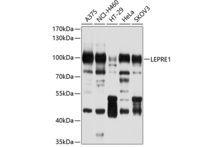 Western Blot - Anti-LEPRE1/P3H1 Antibody (A11286) - Antibodies.com