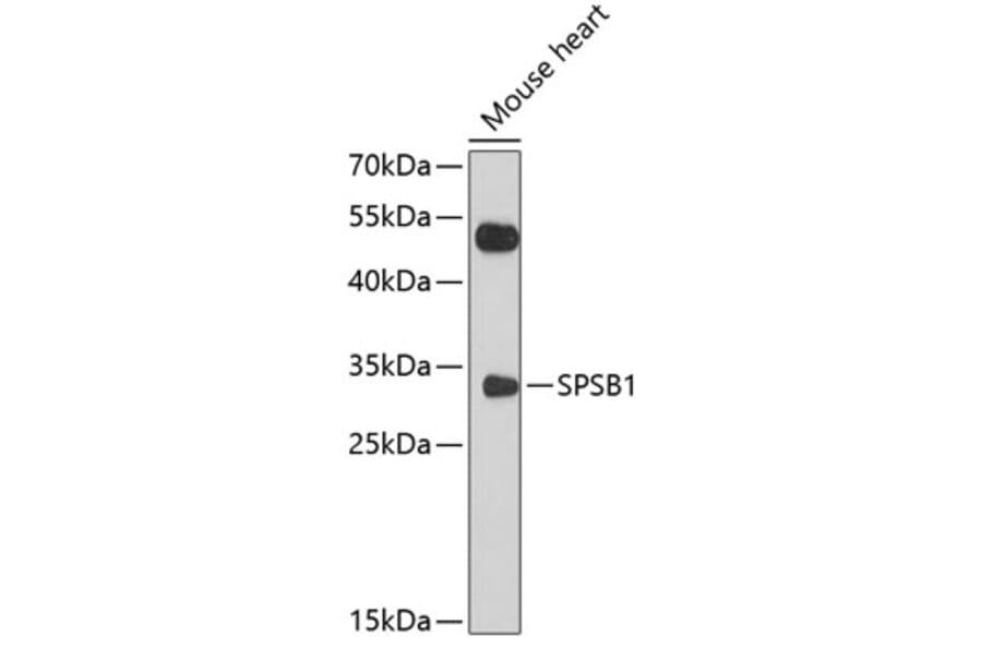 Western Blot - Anti-SSB-1 Antibody (A11287) - Antibodies.com
