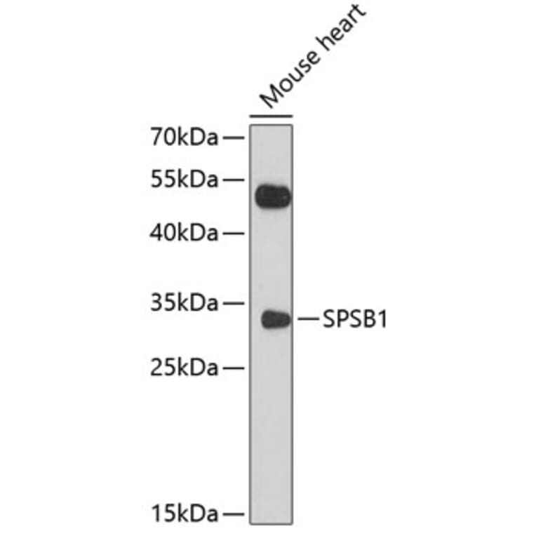 Western Blot - Anti-SSB-1 Antibody (A11287) - Antibodies.com