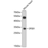 Western Blot - Anti-SSB-1 Antibody (A11287) - Antibodies.com