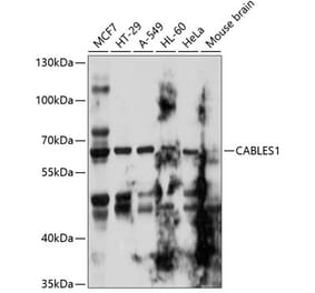 Western Blot - Anti-CABLES1 Antibody (A11288) - Antibodies.com