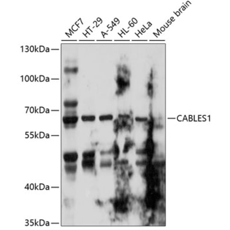 Western Blot - Anti-CABLES1 Antibody (A11288) - Antibodies.com