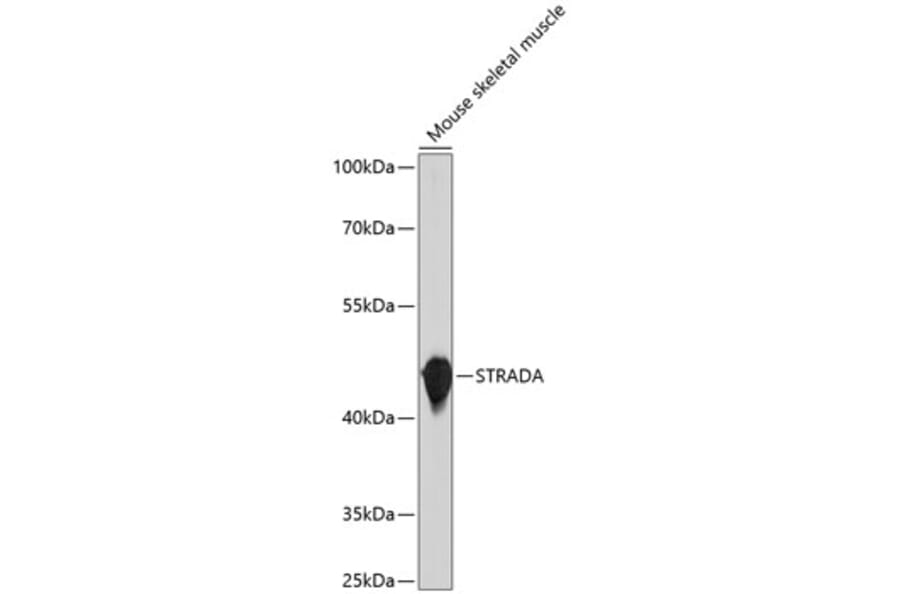 Western Blot - Anti-STRADA Antibody (A10336) - Antibodies.com