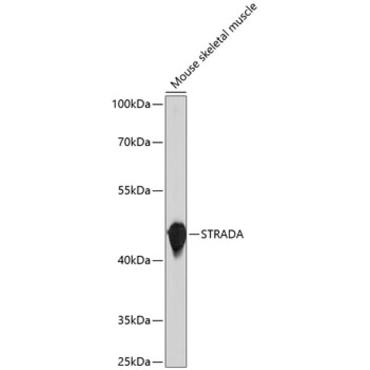 Western Blot - Anti-STRADA Antibody (A10336) - Antibodies.com