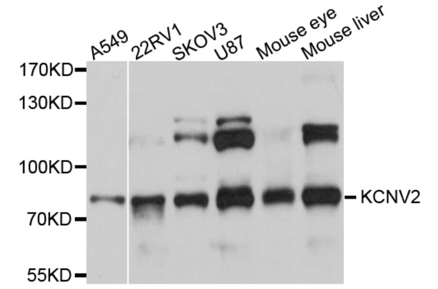 Western Blot - Anti-KCNV2 Antibody (A10340) - Antibodies.com