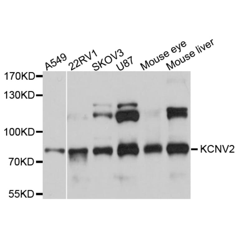Western Blot - Anti-KCNV2 Antibody (A10340) - Antibodies.com