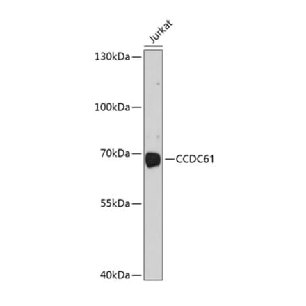 Western Blot - Anti-CCDC61 Antibody (A11291) - Antibodies.com