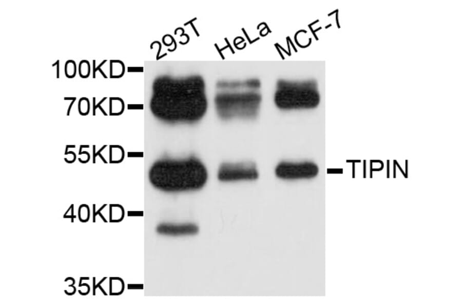 Western Blot - Anti-TIPIN Antibody (A10344) - Antibodies.com
