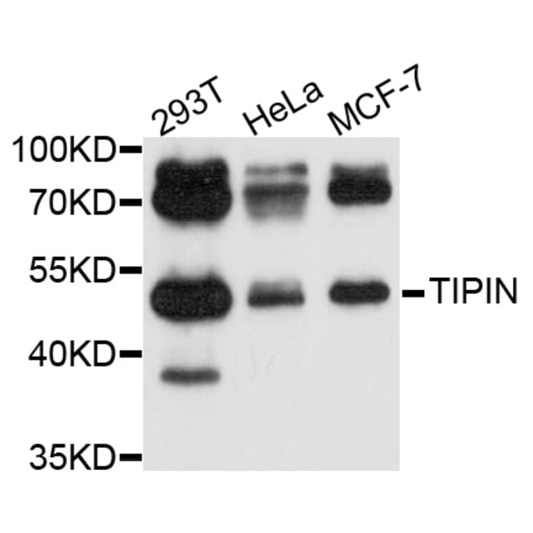 Western Blot - Anti-TIPIN Antibody (A10344) - Antibodies.com
