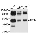 Western Blot - Anti-TIPIN Antibody (A10344) - Antibodies.com
