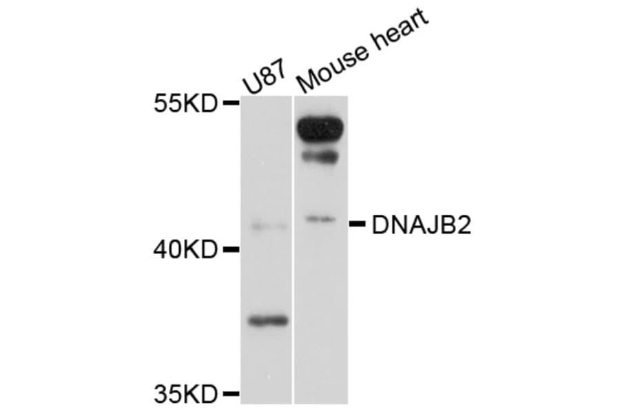 Western Blot - Anti-DNAJB2 Antibody (A10345) - Antibodies.com