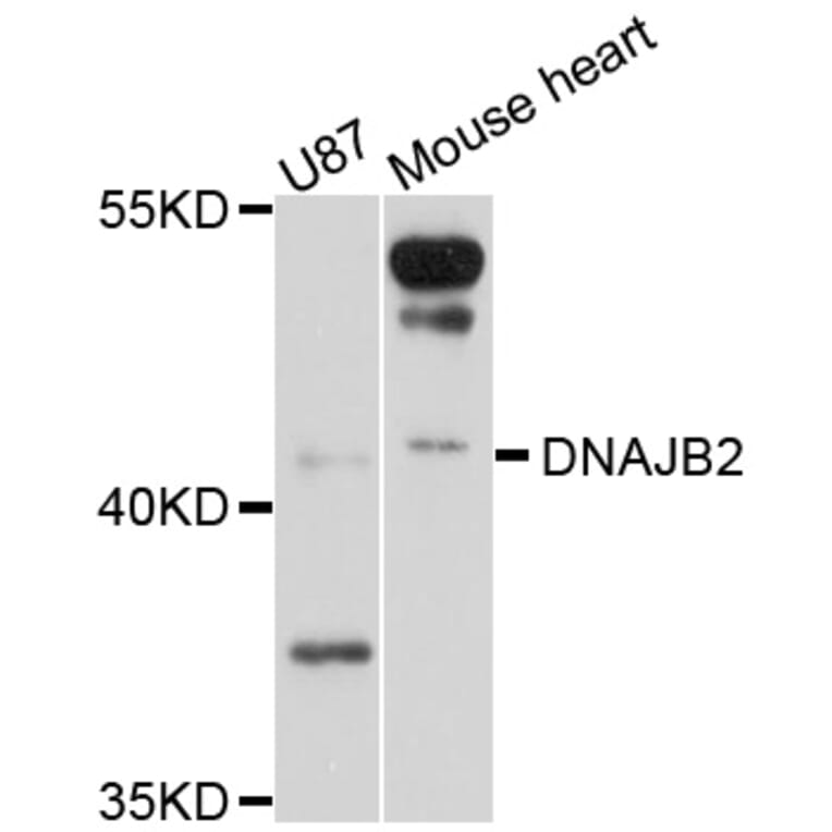 Western Blot - Anti-DNAJB2 Antibody (A10345) - Antibodies.com
