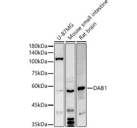 Western Blot - Anti-Dab1 Antibody (A11295) - Antibodies.com