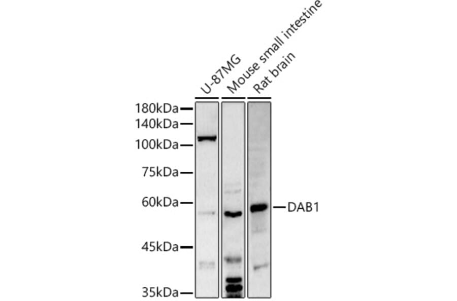Western Blot - Anti-Dab1 Antibody (A11295) - Antibodies.com