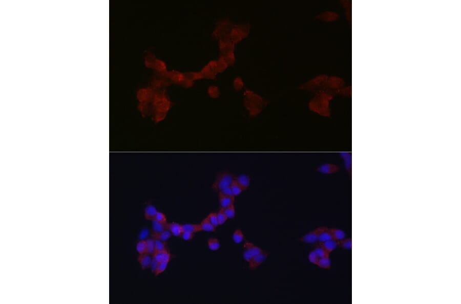 Immunofluorescence - Anti-Dab1 Antibody (A11295) - Antibodies.com