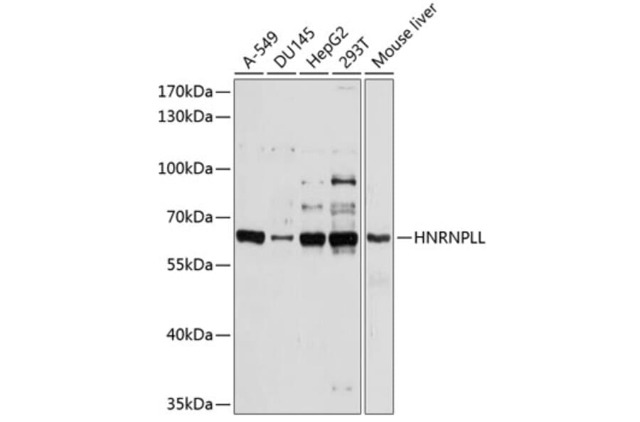 Western Blot - Anti-HNRNPLL Antibody (A11296) - Antibodies.com