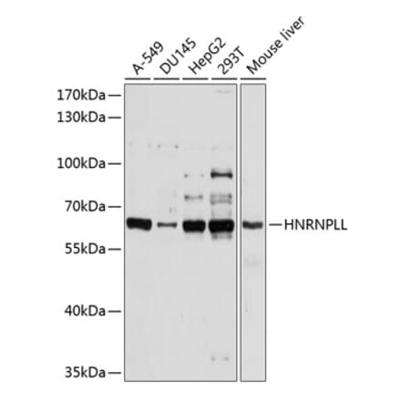 Western Blot - Anti-HNRNPLL Antibody (A11296) - Antibodies.com