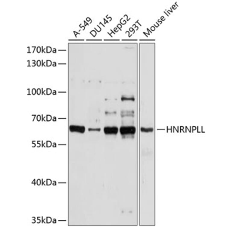 Western Blot - Anti-HNRNPLL Antibody (A11296) - Antibodies.com