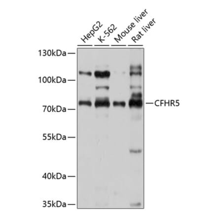 Western Blot - Anti-CFHR5 Antibody (A11297) - Antibodies.com