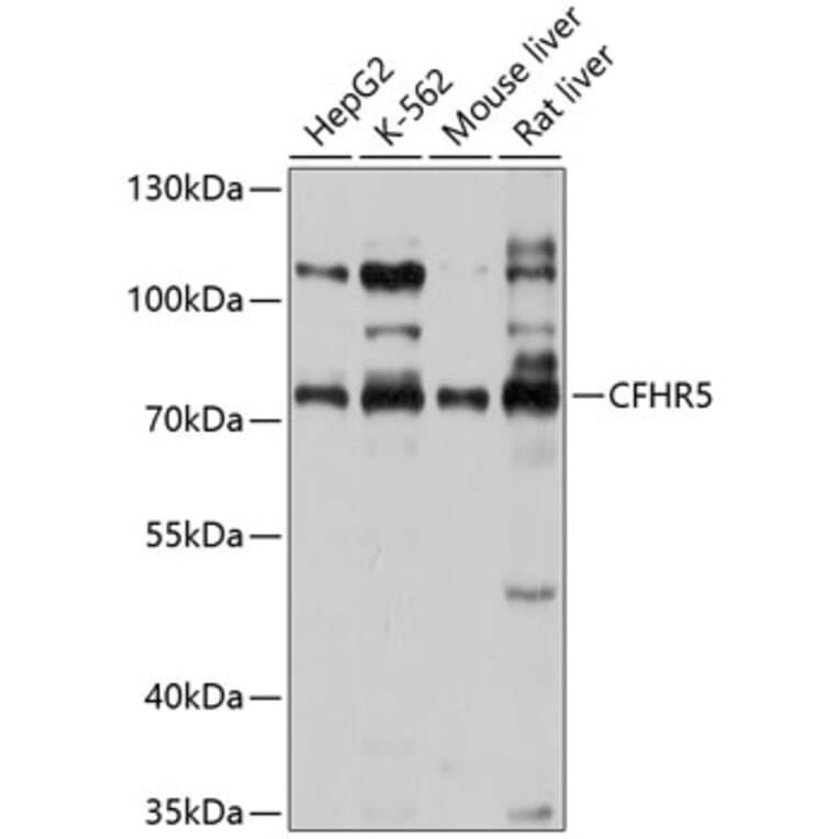 Western Blot - Anti-CFHR5 Antibody (A11297) - Antibodies.com