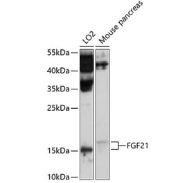Western Blot - Anti-FGF21 Antibody (A11298) - Antibodies.com