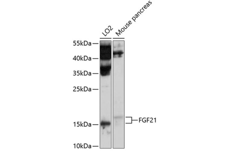 Western Blot - Anti-FGF21 Antibody (A11298) - Antibodies.com