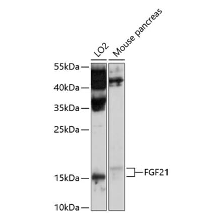 Western Blot - Anti-FGF21 Antibody (A11298) - Antibodies.com