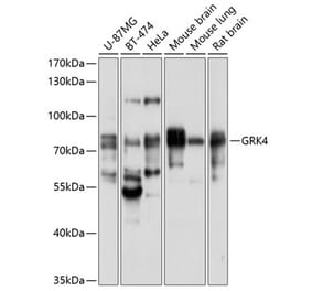 Western Blot - Anti-GRK4 Antibody (A11299) - Antibodies.com