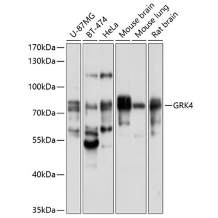 Western Blot - Anti-GRK4 Antibody (A11299) - Antibodies.com