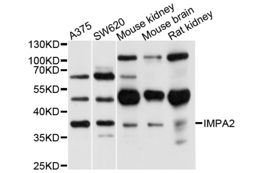 Western Blot - Anti-IMPA2 Antibody (A10371) - Antibodies.com