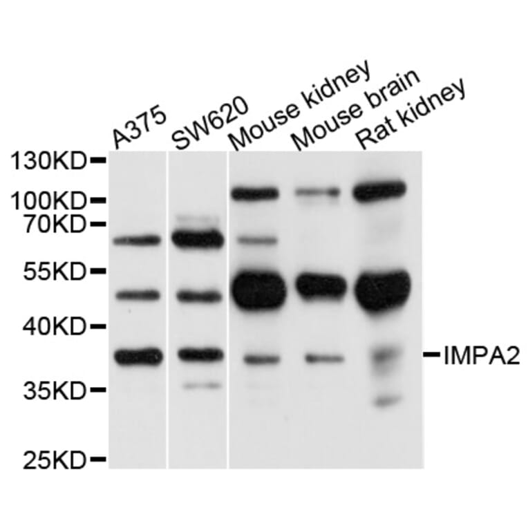Western Blot - Anti-IMPA2 Antibody (A10371) - Antibodies.com