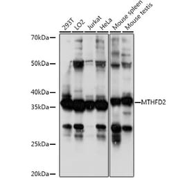 Western Blot - Anti-MTHFD2 Antibody (A11302) - Antibodies.com