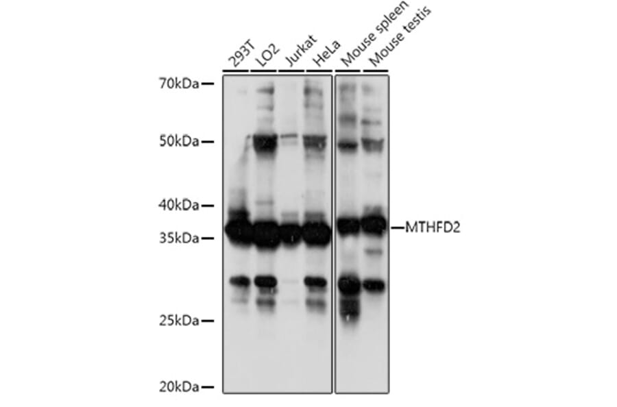 Western Blot - Anti-MTHFD2 Antibody (A11302) - Antibodies.com
