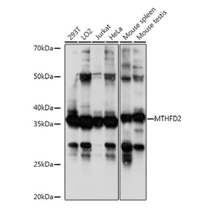 Western Blot - Anti-MTHFD2 Antibody (A11302) - Antibodies.com