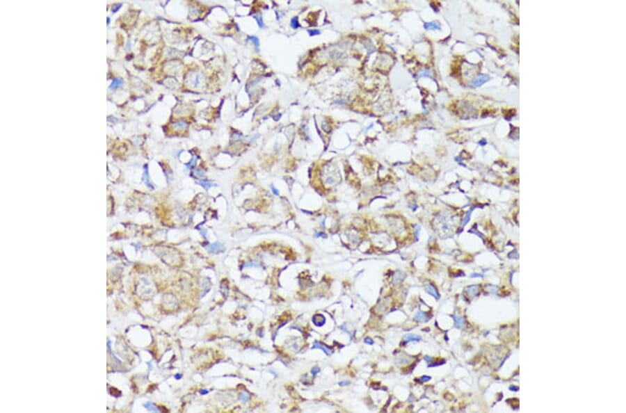 Immunohistochemistry - Anti-MTHFD2 Antibody (A11302) - Antibodies.com