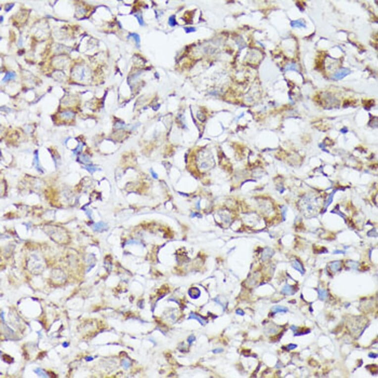 Immunohistochemistry - Anti-MTHFD2 Antibody (A11302) - Antibodies.com