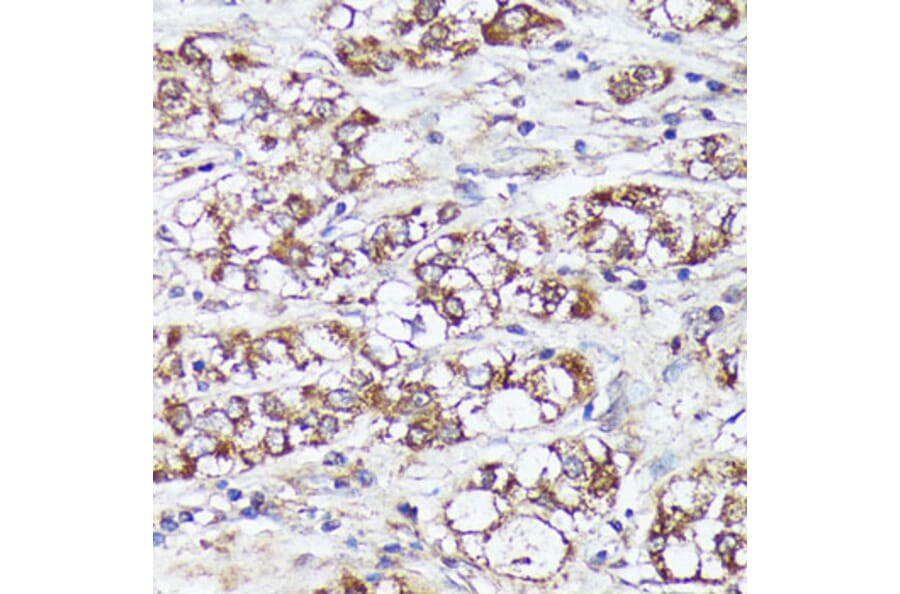 Immunohistochemistry - Anti-MTHFD2 Antibody (A11302) - Antibodies.com