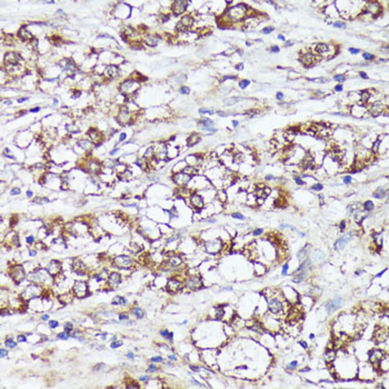 Immunohistochemistry - Anti-MTHFD2 Antibody (A11302) - Antibodies.com