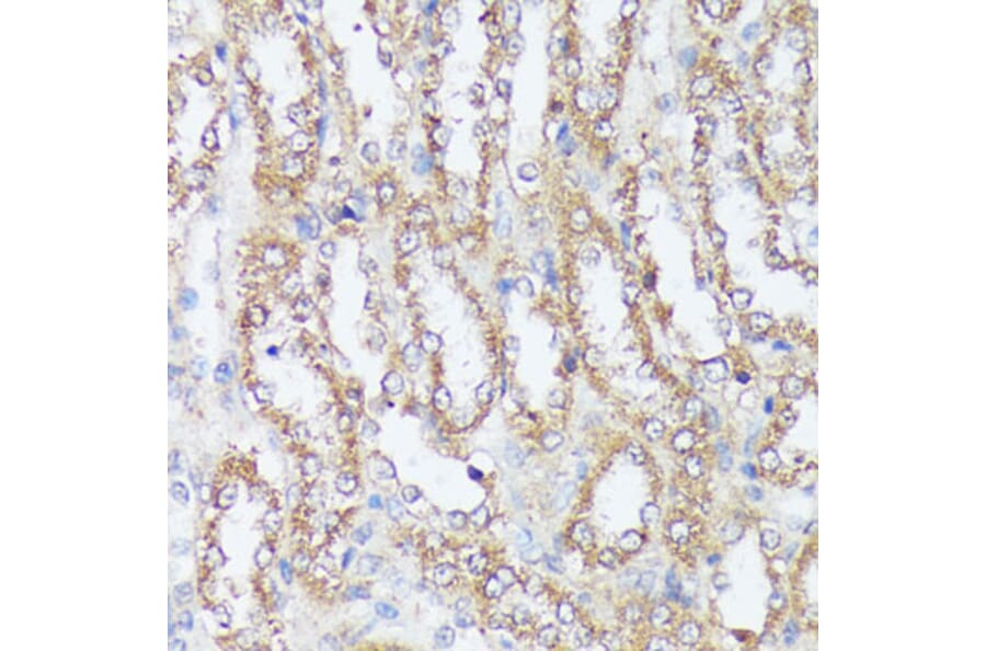 Immunohistochemistry - Anti-MTHFD2 Antibody (A11302) - Antibodies.com