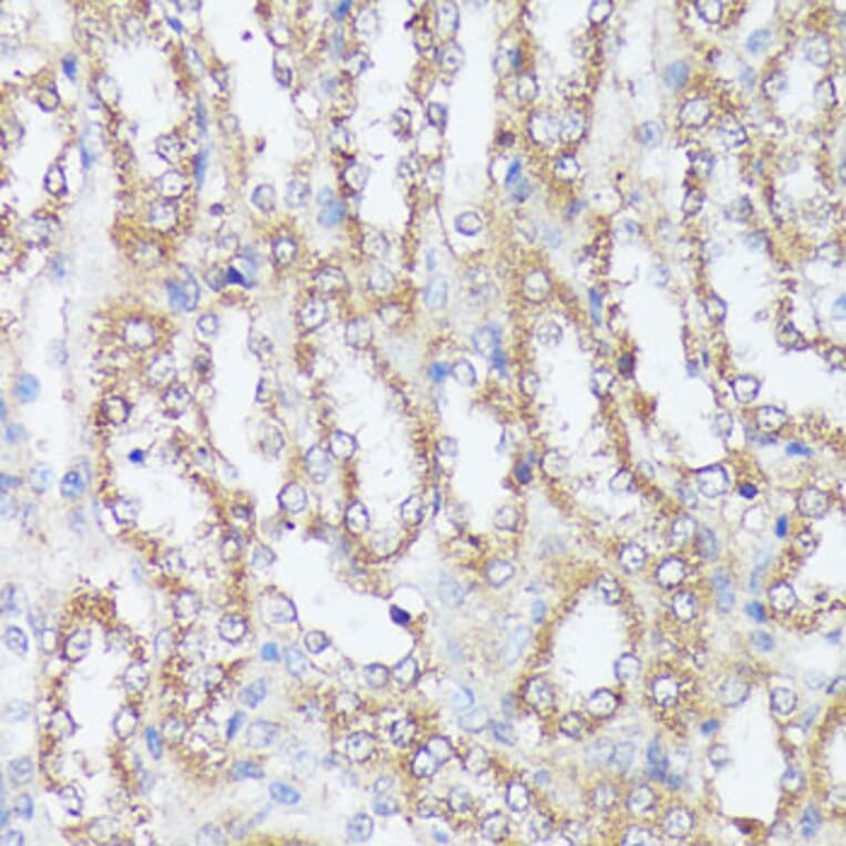 Immunohistochemistry - Anti-MTHFD2 Antibody (A11302) - Antibodies.com