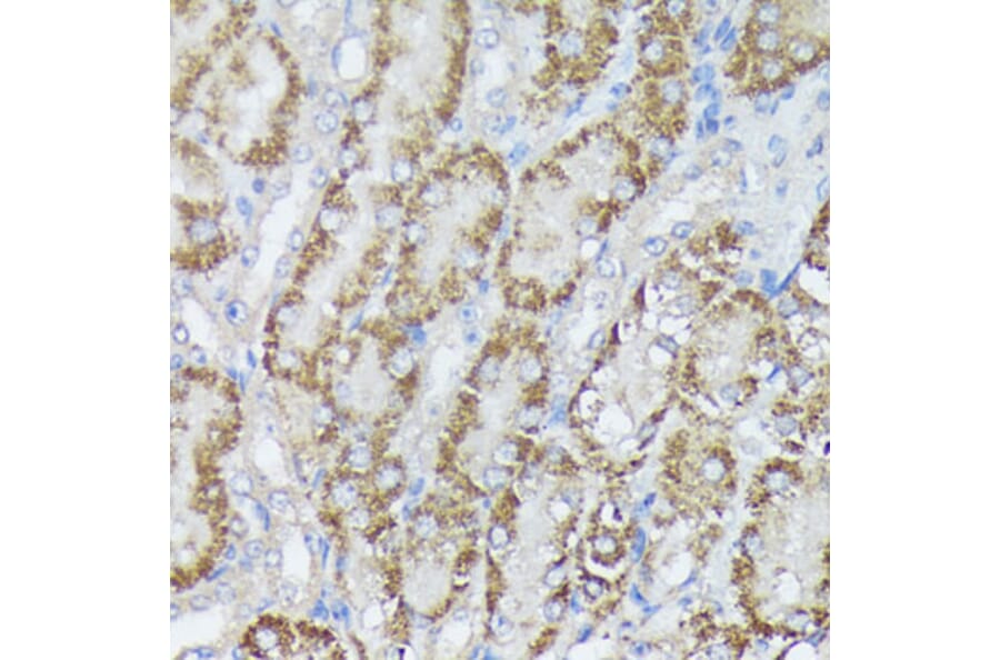 Immunohistochemistry - Anti-MTHFD2 Antibody (A11302) - Antibodies.com