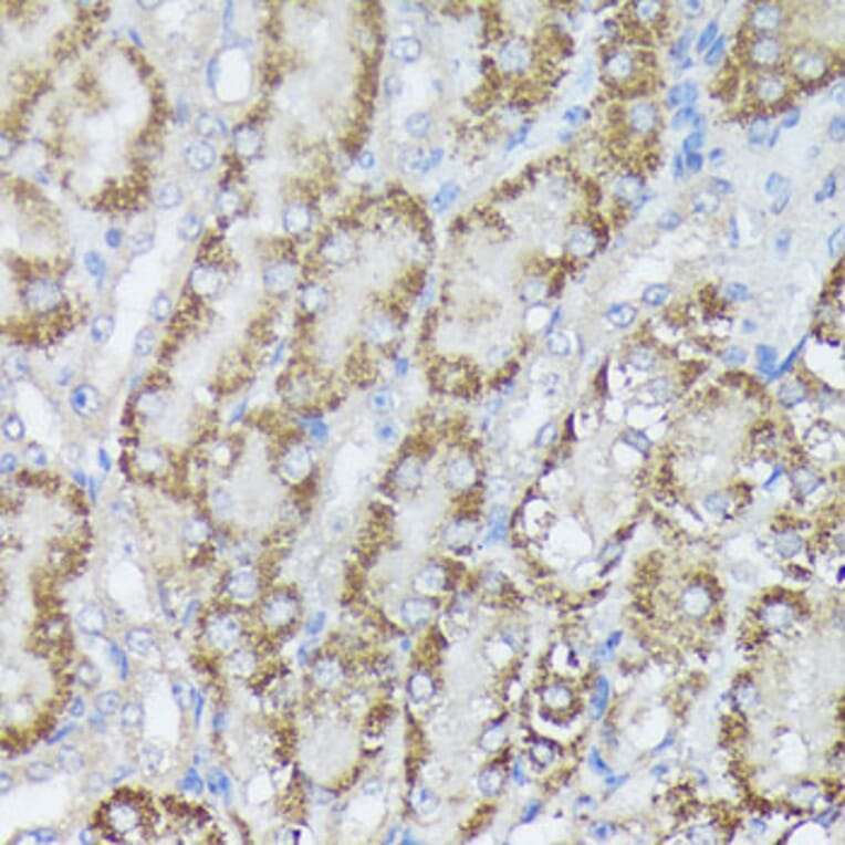 Immunohistochemistry - Anti-MTHFD2 Antibody (A11302) - Antibodies.com