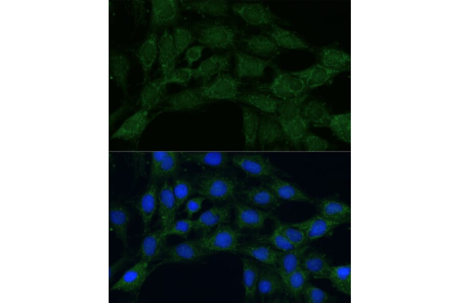 Immunofluorescence - Anti-MTHFD2 Antibody (A11302) - Antibodies.com