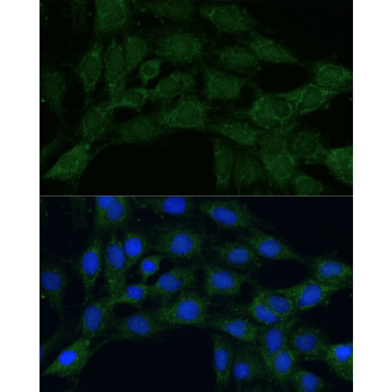 Immunofluorescence - Anti-MTHFD2 Antibody (A11302) - Antibodies.com